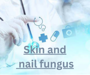 Skin and nail fungus